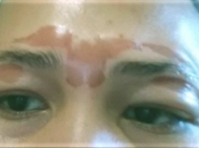 Before-DNA Stem Cell