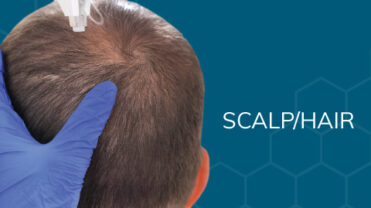 topbanner_ScalpHair topbanner_ScalpHair