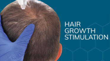 Hair_top-banner